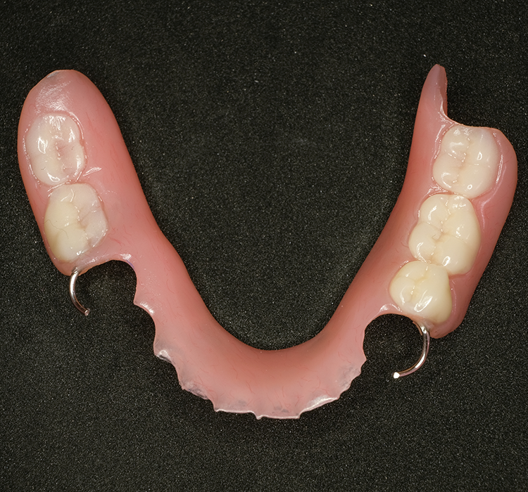 Dentures - Anaheim, California Dentist