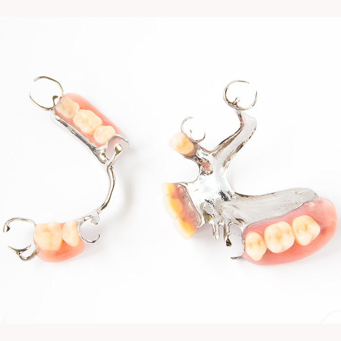 Metal Frame Partial Denture